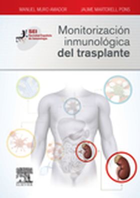 Monitorización inmunológica del trasplante
