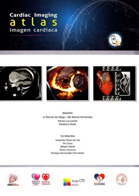ATLAS IMAGEN CARIDACA